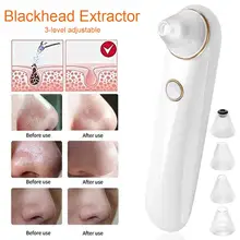 Инструмент для чистки пор с присоской, перезаряжаемый экстрактор черных точек, уход за кожей лица, Глубокая чистка, Электрический Очиститель черных точек