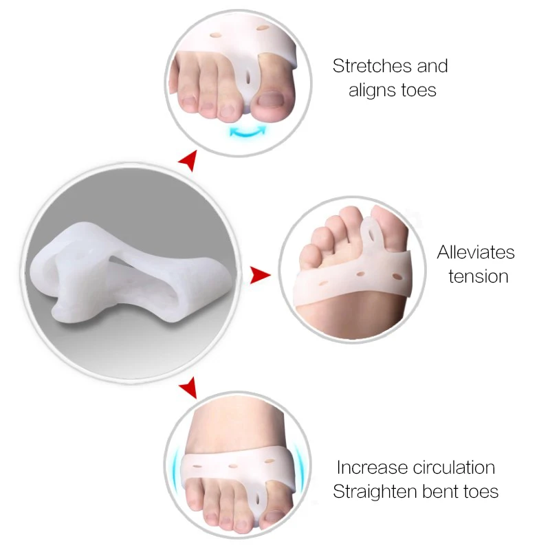 1pair=2pcs Hallux Valgus Bunion Corrector Forefoot Pads Bone Thumb Orthopedic Brace Silicone Big Toe Separator Orthopedic Mats