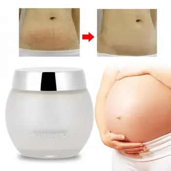 

Makeup Tool Stretch Mark Removal Repair Body Cream Skin Moisturzing Whitening for Pregnancy Women