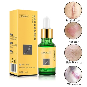 

20ml Scar Repair Essential Oil Remove Pregnancy Scars Acne Serum Stretch Marks Treatment Maternity Repair Anti-Winkles Body Care