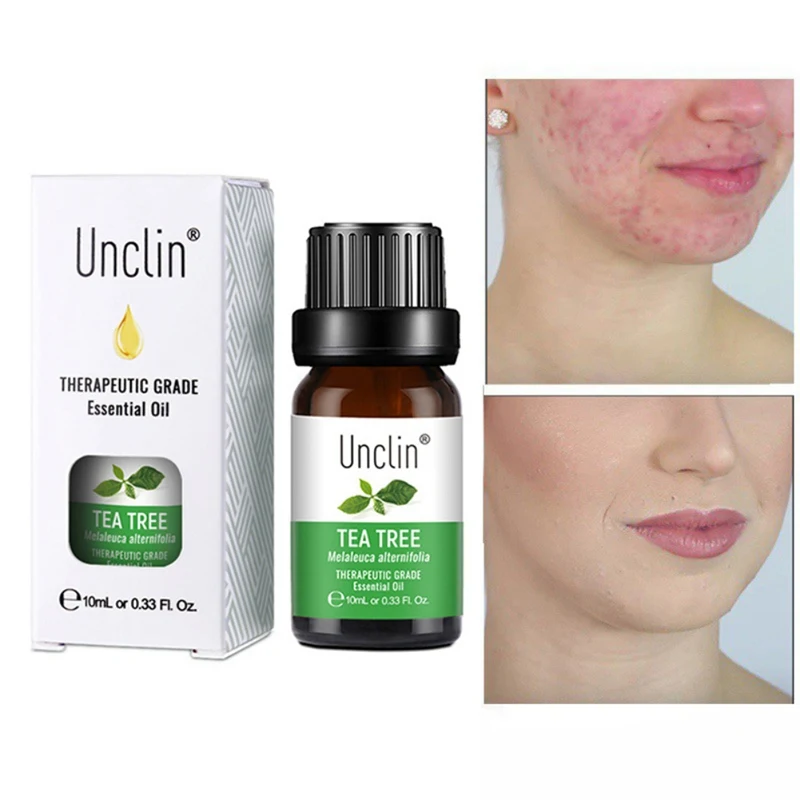 

Skin Care Natural Tea Tree Essential Oil Anti-wrinkle Extract Acne Removal Scars Marks Treatment Essential Oil Beauty