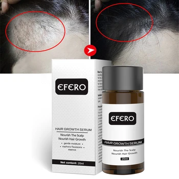 

20ml Hair Growth Essence Fluid Fast Powerful Hair Care Essential Serum Preventing Hair Loss Products Restoration Pilatory