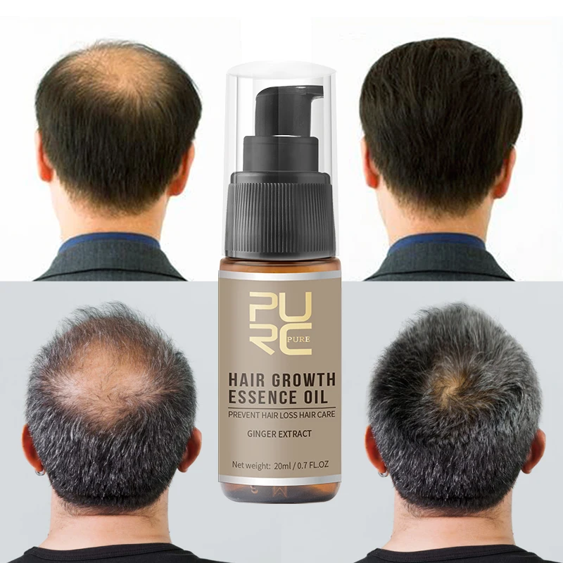 PURC горячая Распродажа эссенция для быстрого роста волос масло для лечения выпадения волос помощь для роста волос уход за волосами экстракт имбиря 20 мл TSLM2
