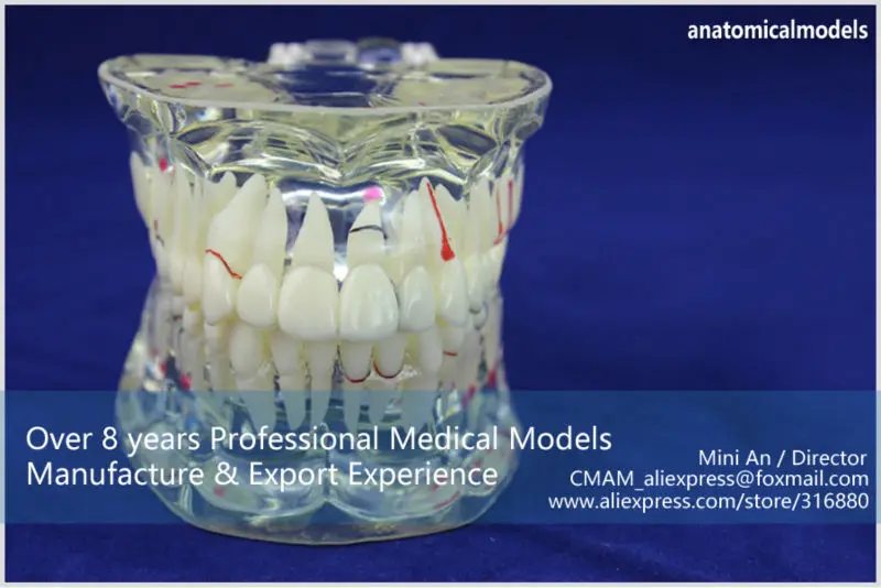 T CMAM/12568 Dental-patological Стоматологическая модель, demo, Human Oral Dental медицинское обучение анатомическая модель