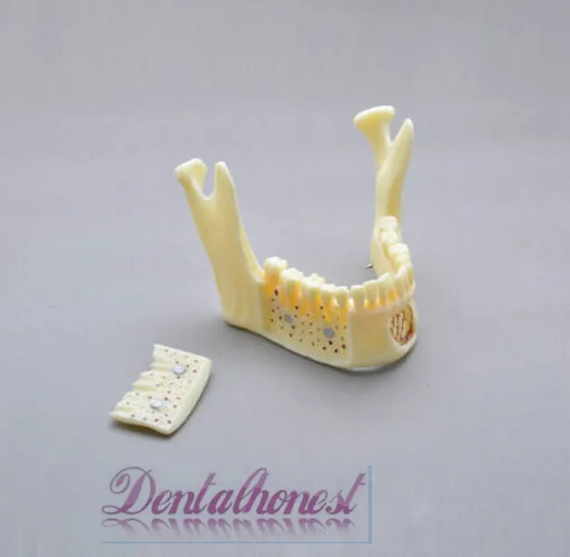 Dentalmall Стоматологическая модель#5004 02-Съемная профессиональная модель черепа