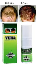 100% Herbal and Safe Natural Hair Growth Hair Regain Restoration Bald Hair Pilatory Stop Hair Loss Products