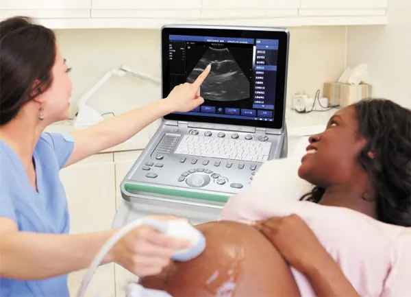 Portable-ultrasound-scanner-Laptop-type-ultrasound-SS (3)