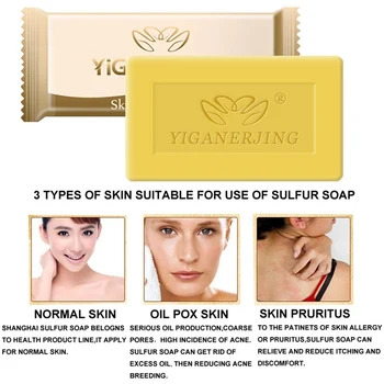 

New 2019 5pcs Sulfur Soap Control Oil Mild No Stimulation Pure Natural Skin Cleansing Soap