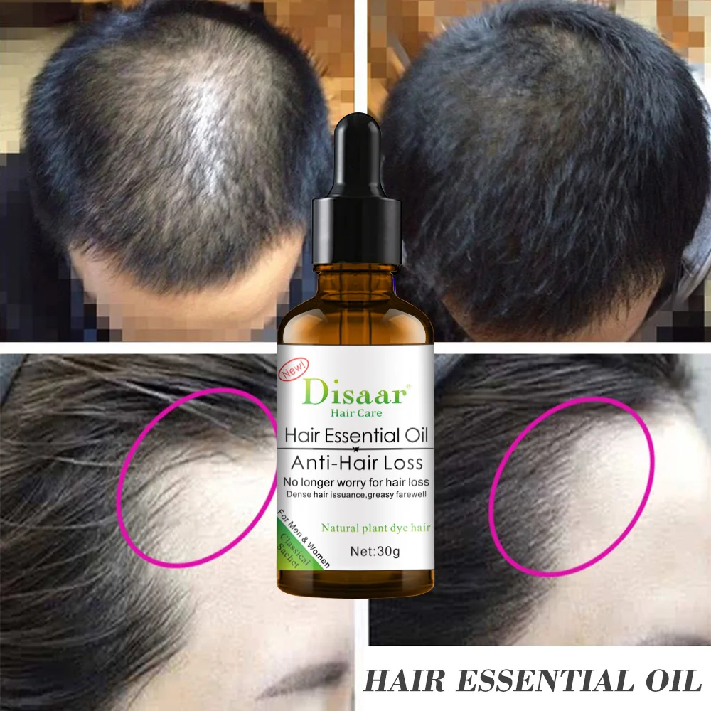 Hair Growth Development Essence Anti-hair loss Hair Care Deep Nourishment Hair Conditioner Essential oil 30ml