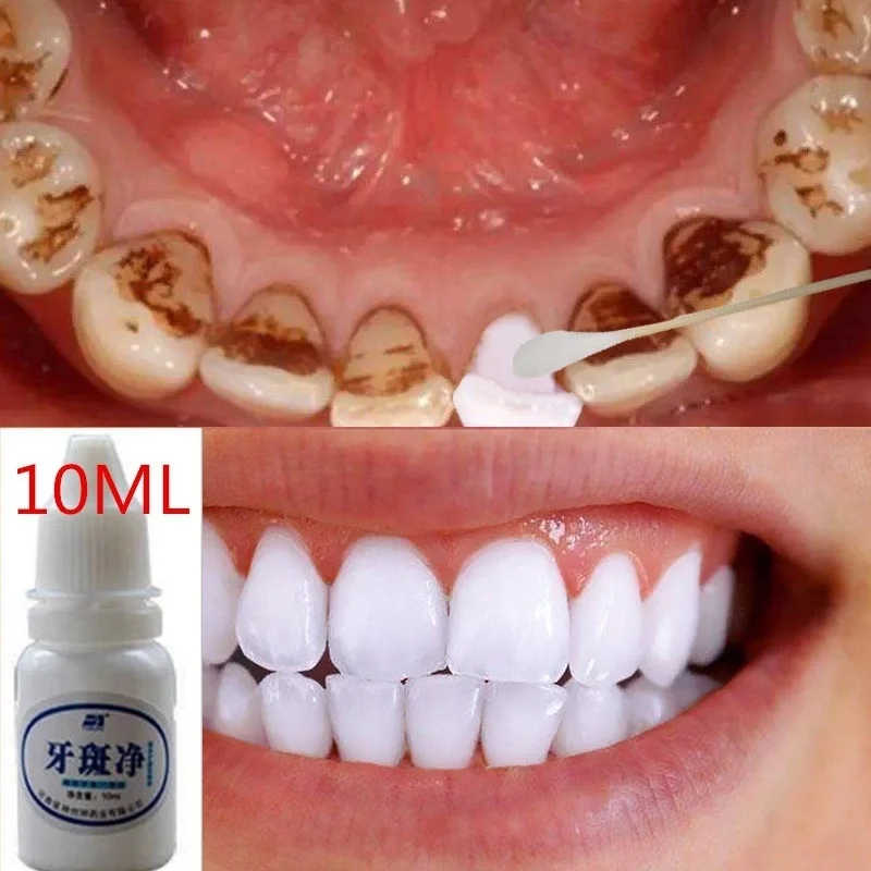 

10ml Tooth Whitening Essence Liquid Magic White Teeth Oral Hygiene Charcoal Teeth Whitening Cleaning Water Clareamento Dental