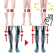 1 пара, новинка, хит, для мужчин и женщин, силиконовая, O/X, для ног, корректирующая подушка, Ортопедическая, поддержка стелек, арки, ортопедические, случайные, для здоровья ног