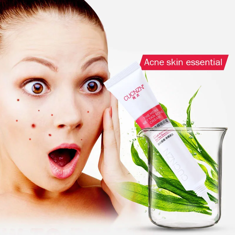 Anti Acne Face Cream Mild Herbal Formula Care Oil Control Moisturizing