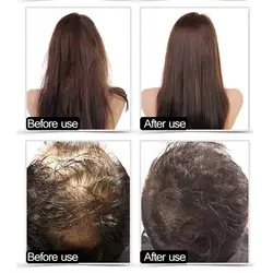 20 мл Кератиновое эфирное масло для волос питающий кожу головы Восстанавливающий сухой уход за волосами YUF99