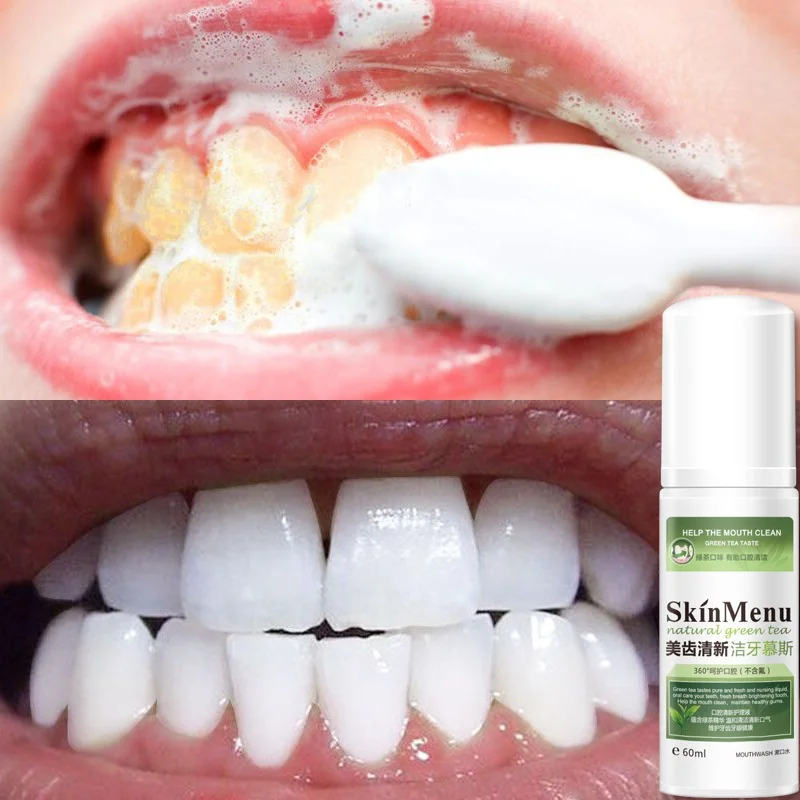 Teeth Cleaning Mousse Teeth Whitening Fresh Breath Tooth Stains Remove Oral Cleaning Foam Whitening Toothpaste 60ml Recommend