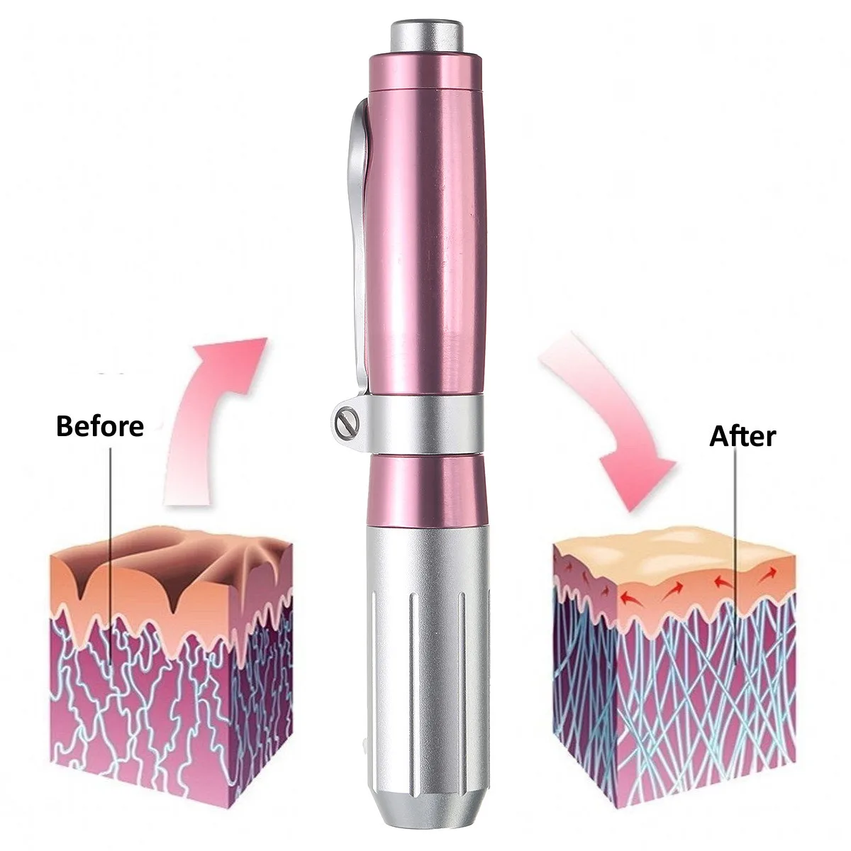 0,5 мл гиалуроновая инъекционная ручка, массажный распылитель, ручка, набор, высокое давление, кислотные пистолеты, против морщин, водный шприц, игла для инъекций, розовый цвет