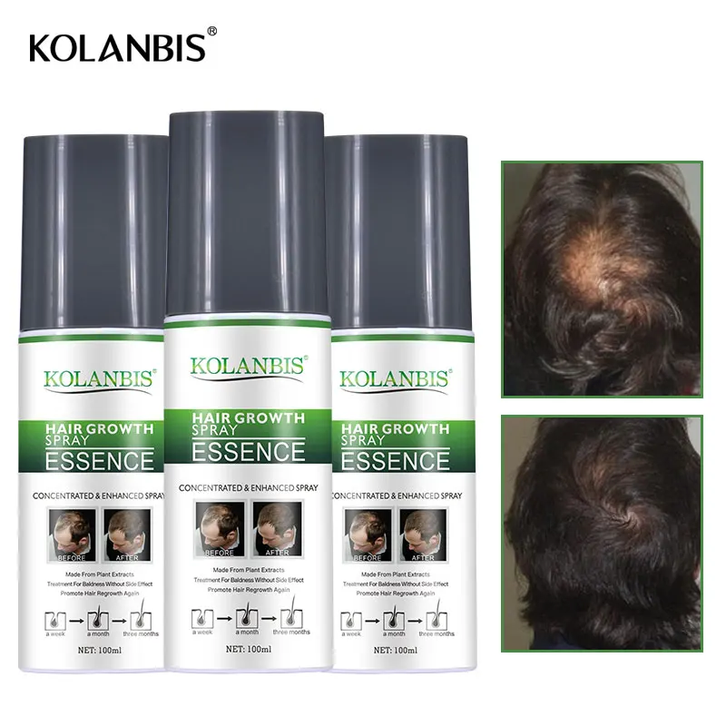 3 bottles ginseng stimulate growth serum spray for hair fall follicle scalp treatment man grow thickener regrowth product
