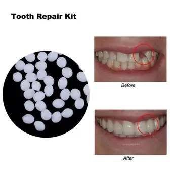 

10g/100g Temporary Resin Tooth Repair Kit Teeth And Gap Denture Solid Glue Dental Restoration Adhesive Teeth Oral Care Tool