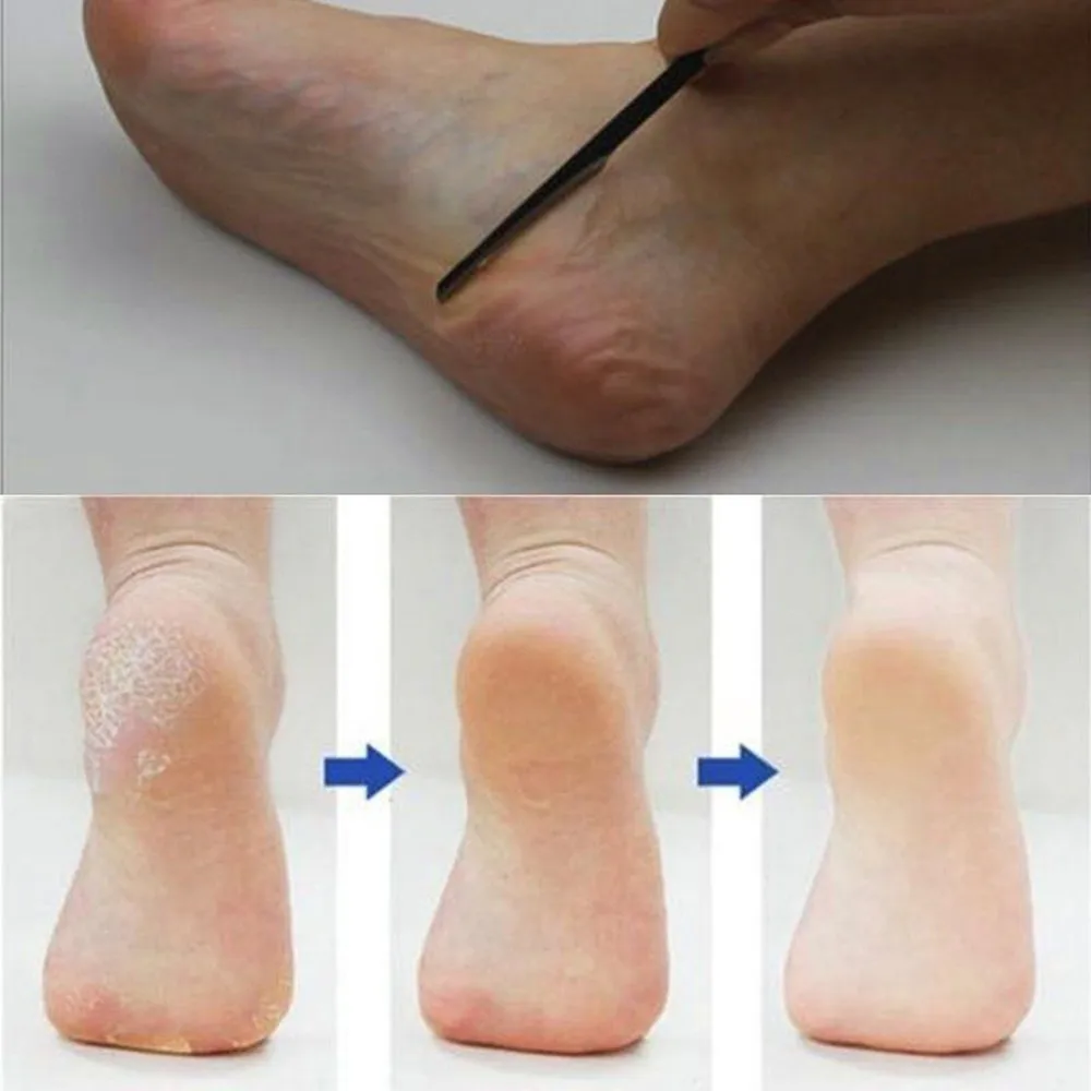 

Pro Pedicure Manicure Nail Cleaner Cuticle Grooming Dead Skin Planer Beauty Foot Care Drop Shipping Dode huidschaaf