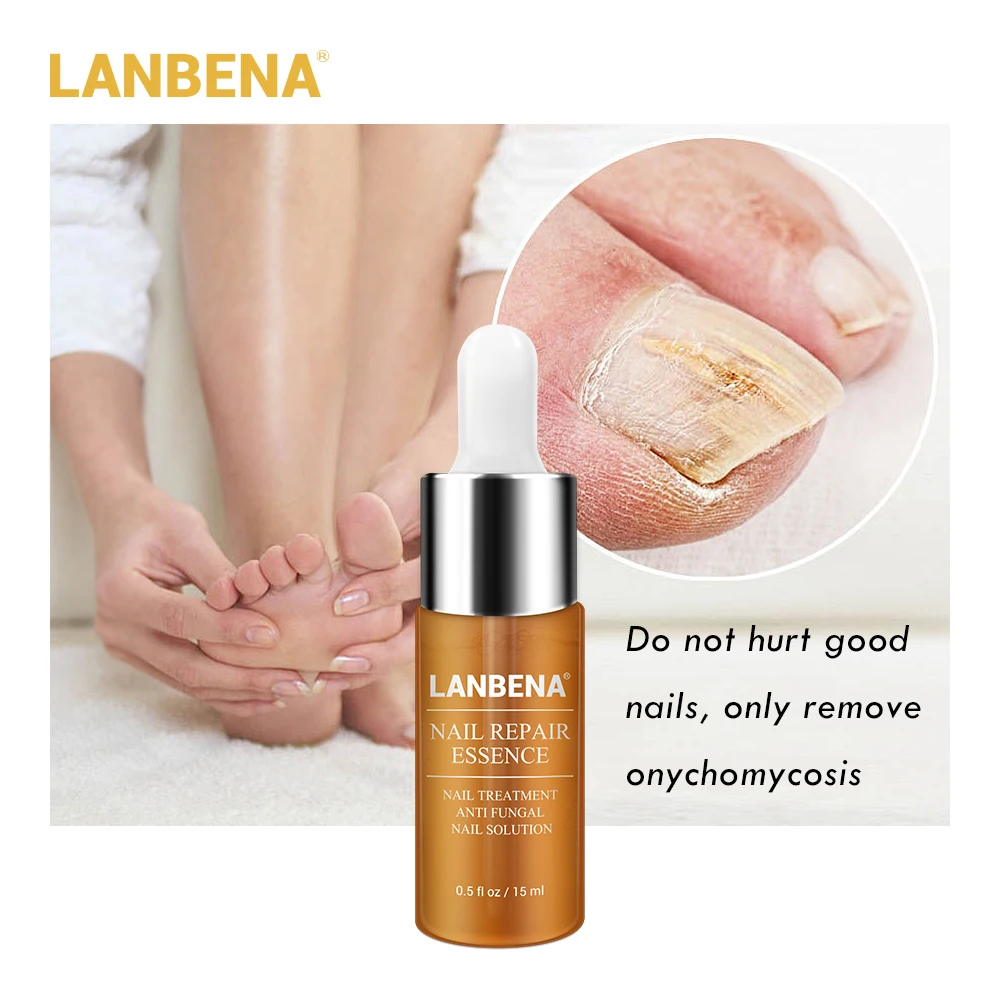 LANBENA Nail Repair Essence Serum Fungal Nail Treatment Remove Onychomycosis Toe Nail Nourishing Brightening Hand And Foot Care LANBENA Nail Repair Essence Serum Fungal Nail Treatment Remove Onychomycosis Toe Nail Nourishing Brightening Hand And Foot Care