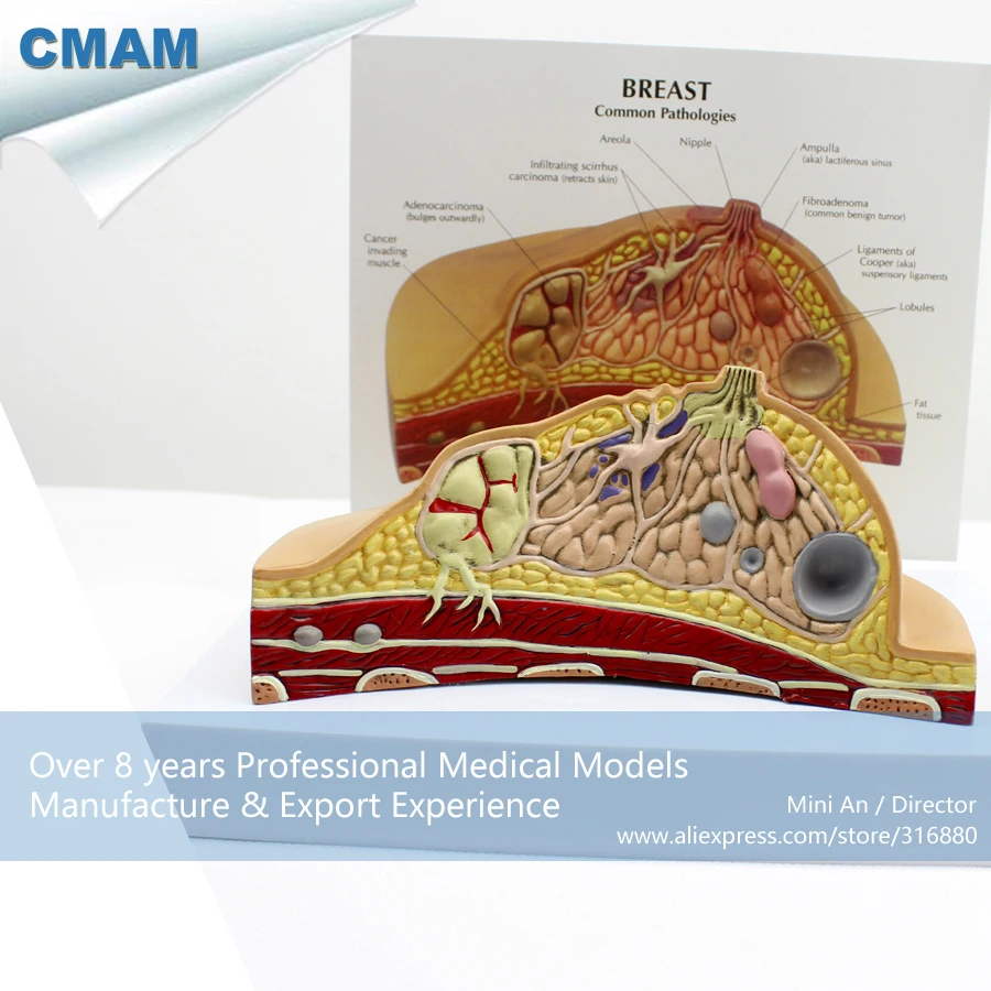 12461 CMAM ANATOMY23 Female Breast Common Pathologies Cross section