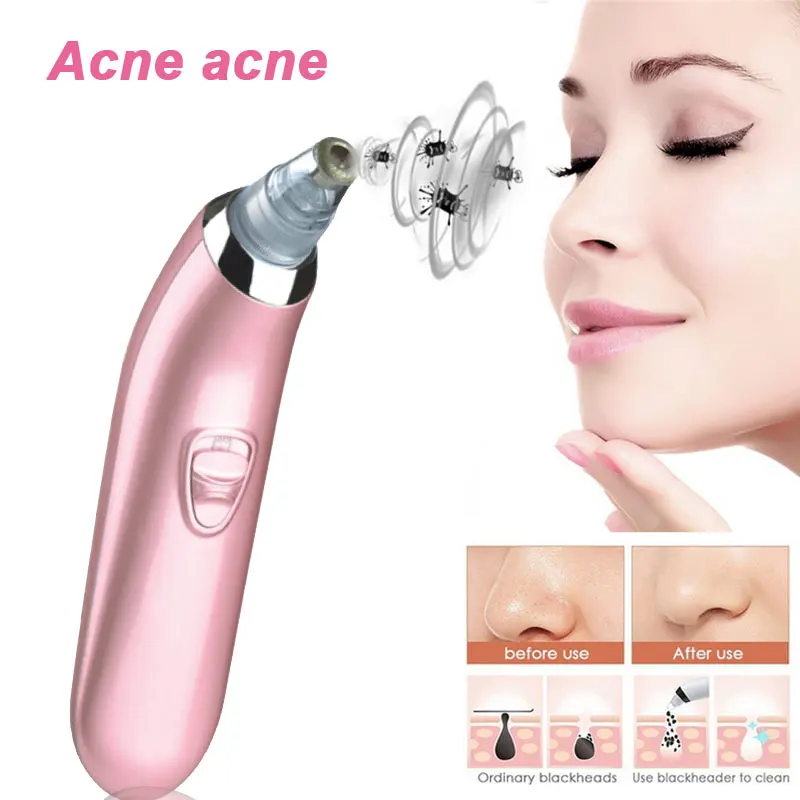 

Acne Removing Apparatus Pores Cleaner Pink Deep Clean Beauty Supply Blackhead Removing Tool Acne Remover Clean Pore