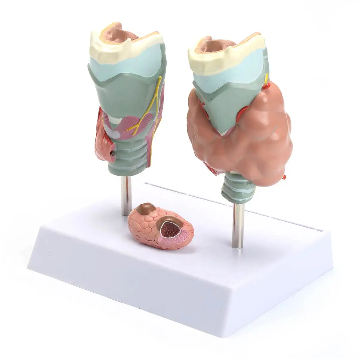 

PVC Human Anatomical Thyroid Gland Pathology Laryngeal Anatomy Teaching Resource Model Educational Props Medical Science