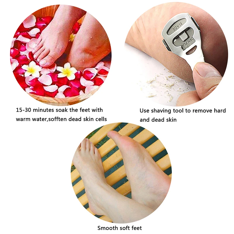 How To Put A Blade On A Foot Shaver at Nancy Messer blog