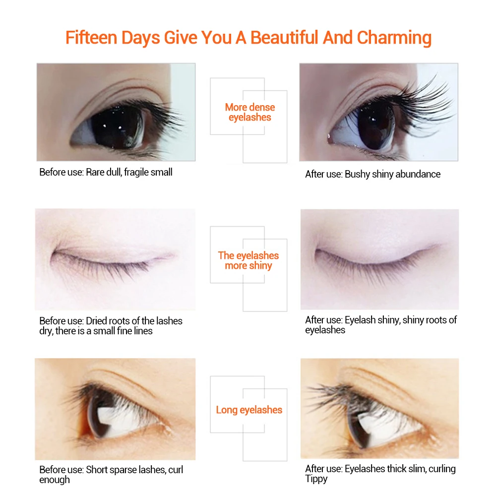 Communication on this topic: How to Use Eyelash Growth Serum, how-to-use-eyelash-growth-serum/ Communication on this topic: How to Use Eyelash Growth Serum, how-to-use-eyelash-growth-serum/