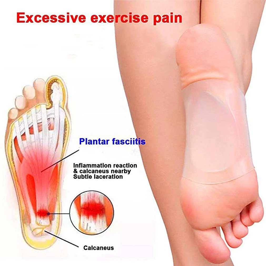 Abdb-арка поддерживаемая Мягкая Арка поддерживает стельки для плоских ног подошвенный Fasciitis боли рельеф колодки для обуви