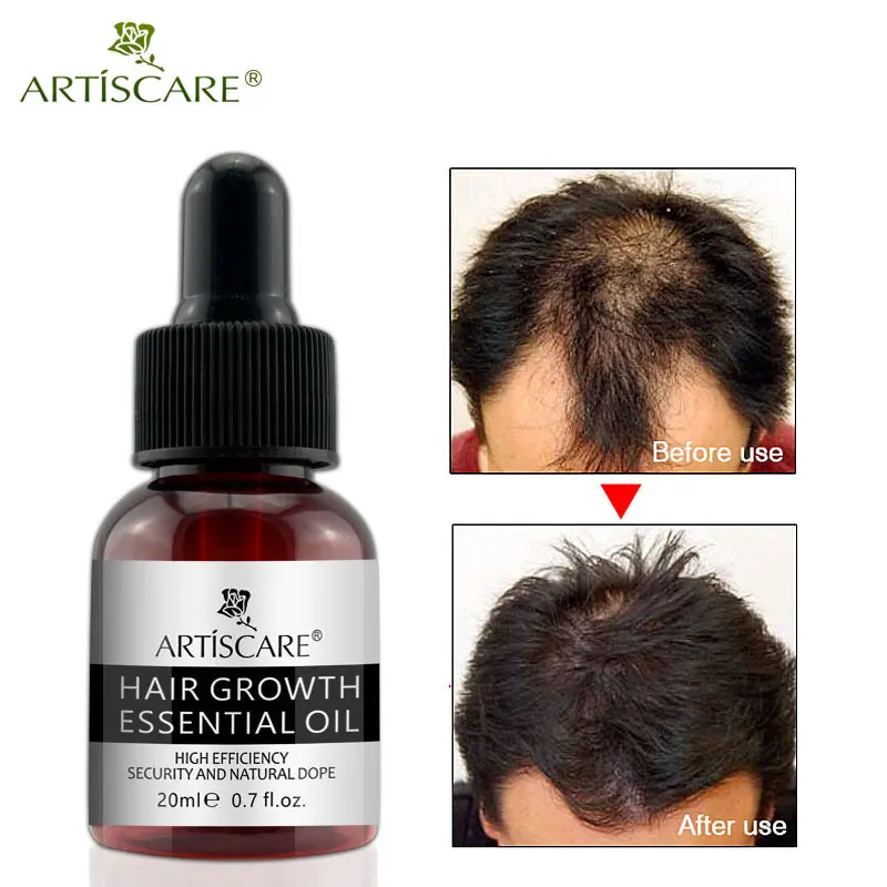 ARTISCARE Hair Growth Essential Oil Anti Hairs Loss Liquid Hair Repair Treatment Dense Hair Regrowth Serum Health Care Beauty