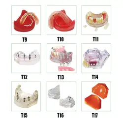 Полный протез режим имплантат зубные беззубой модель Имплантат практика модель с импортные смолы