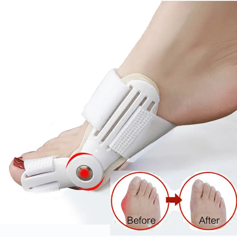 1 Pair Toe Separator Hallux Valgus Correction 24 Hours Bunion Orthotics Enhanced Adjuster Big Toe Corrector Orthotics Feet Care