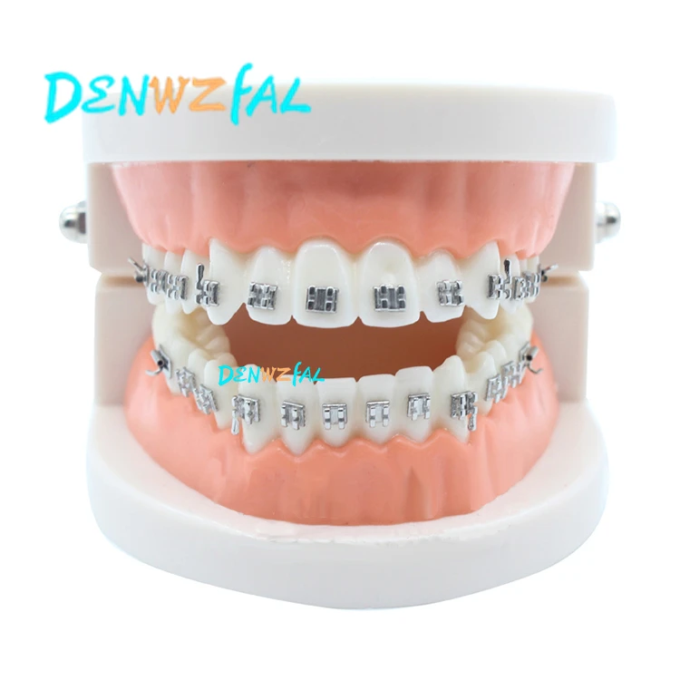 Новая Ортодонтическая модель для стоматологической 1/2 стандартная стоматология с полуметаллический кронштейны половина керамический кронштейн модель зубов