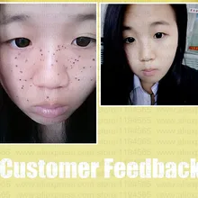 2 шт. набор красок моль бородавки удаление черные пятна брызги Remover