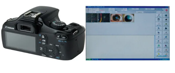 BL-88D 5 увеличение щелевая лампа Микроскоп добавить луч разделитель камеры DLR адаптер пациента программного обеспечения моторизованный стол