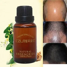 10 ml/Pack Produtos de Aumentar O Crescimento Do Cabelo Perda de Cabelo Anti Perda de Cabelo Alopecia Careca Remédios 100% Natural Ervas Anti Cabelo Tratamento da Perda de
