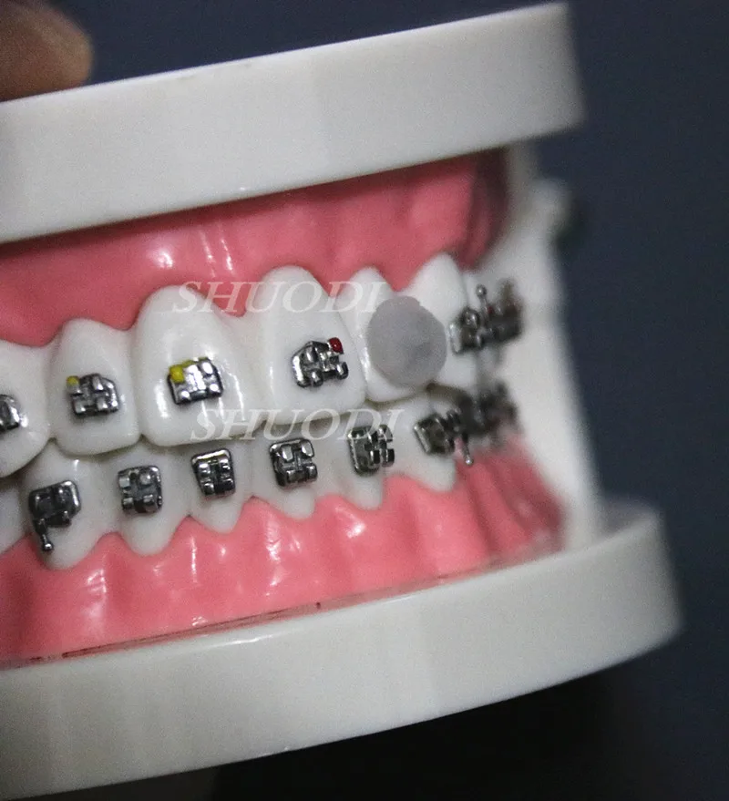 20 коробок/упаковка ортодонтический воск для отбеливания зубов|orthodontic wax|teeth