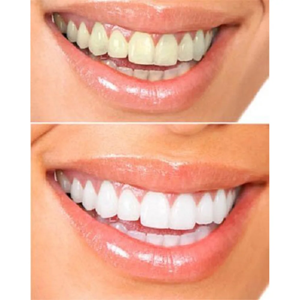 3 зубных шприц для зубов отбеливающий зуб отбеливатель гигиена полости рта с