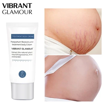 

VIBRANT GLAMOUR 2019 Stretch Mark Cream Remove Pregnancy Scars Acne Cream Treatment Body Cream Natural Plant Nourishing Essence