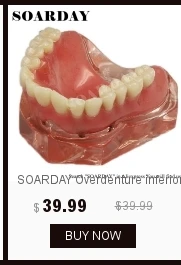 SOARDAY Overdenture низкого качества с 4 импланты с шероховатой поверхностью стоматологический для обучения зуб зубы стоматолог стоматология зубные полоски