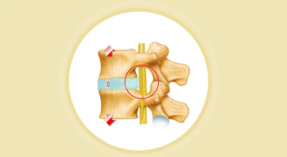 JMRON CR-801 Air Traction Back Brace Cinturón Lumbar Soporte Masajeador de liberación de dolor