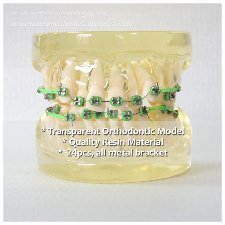 790x790 + - Orthodontic Model