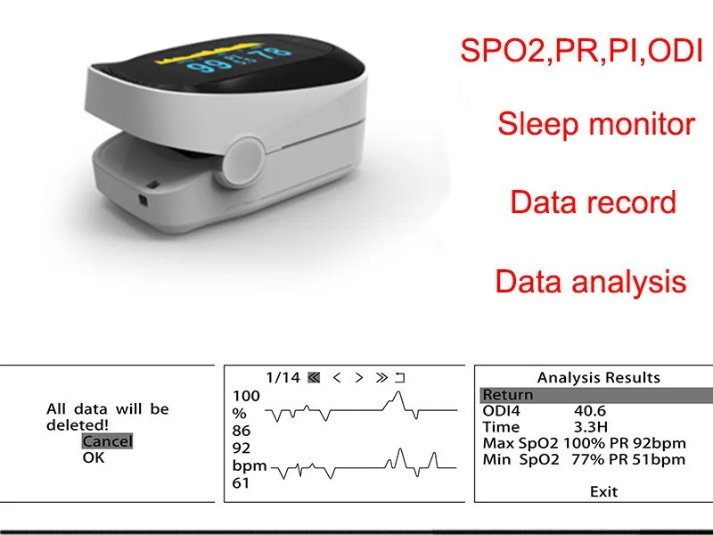 Память хранения мини Пульсоксиметр палец Пульсоксиметр 4 параметры SPO2 PR PI ODI 4 Oximetro De Dedo 8 часов мониторинга сна