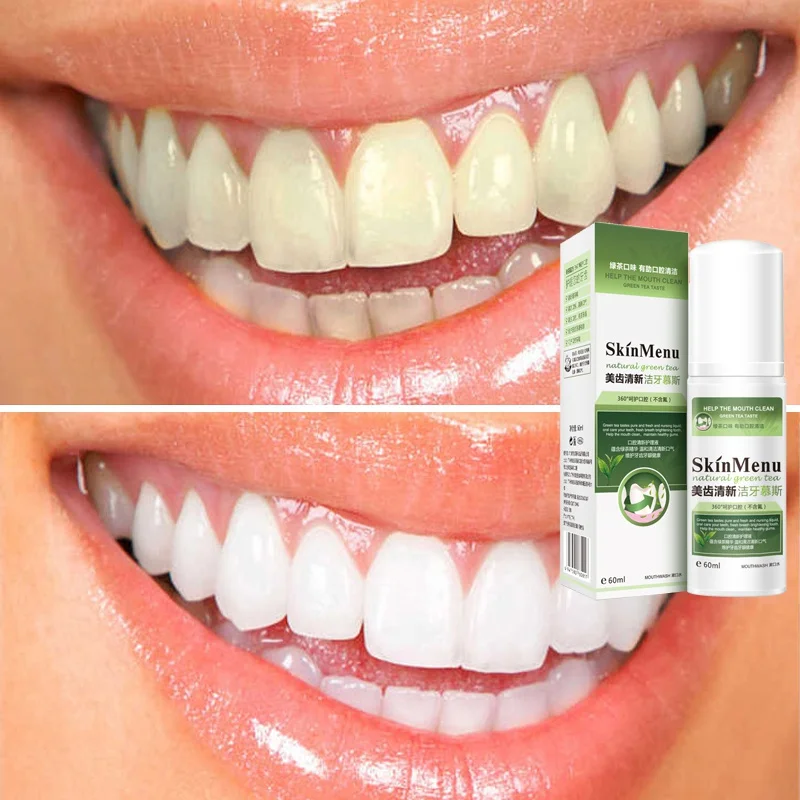 Teeth Cleaning Mousse Teeth Whitening Fresh Breath Tooth Stains Remove Oral Cleaning Foam Whitening Toothpaste 60ml Recommend