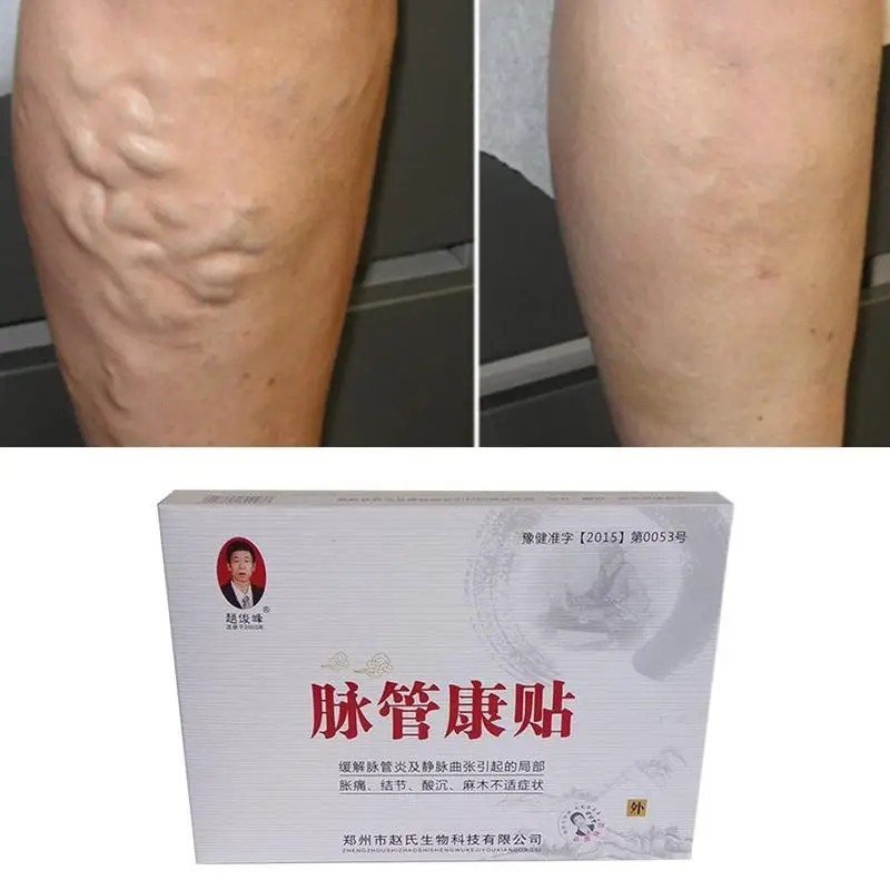 3Pcs/Lot Spider Veins Varicose Treatment Plaster Varicose Veins Cure Patch Vasculitis Natural Solution Herbal Patches