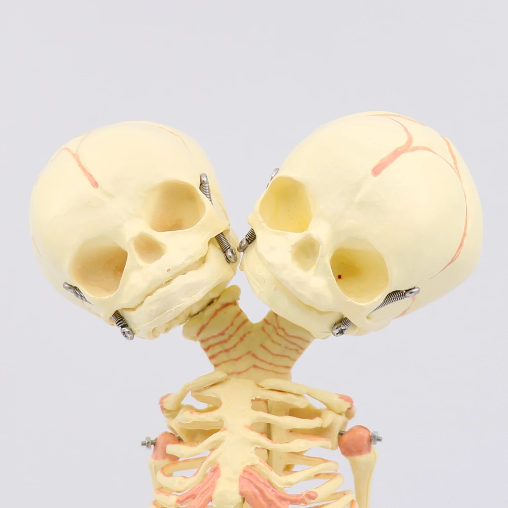 35cm Human New Double Head Baby Anatomy Education Skull Skeleton Study Display