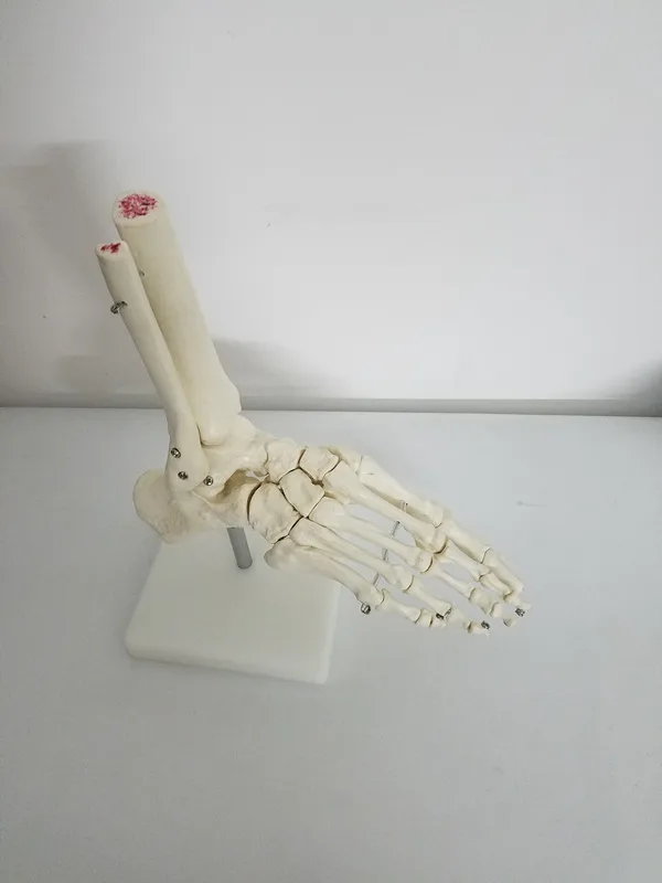 2_