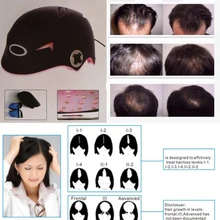 Лазерное оборудование для восстановления волос для продажи 64 диодов