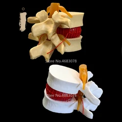 1:1 Human anatomy skeleton Spine Lumbar Disc Herniation Teaching Model brain skull traumatic pistol school medical supplies