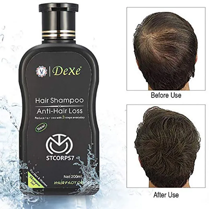 

200ml Herbal Hair Growth Products Hair Loss Shampoo Improve Hair Quality Natural Extract Shampoo Hair Care